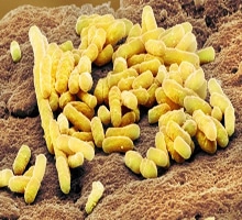 yellow bacteria shown living in colon