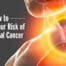 esophageal cancer: learn how to reduce your risk