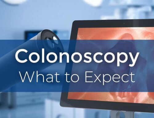 Colonoscopy: Before, During, & After the Procedure