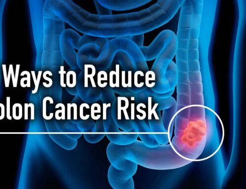 Colon Cancer: 7 Ways to Reduce Your Risk