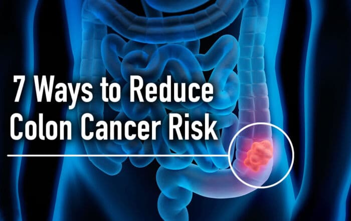 colon cancer risk reduction suggestions with colon anatomy background