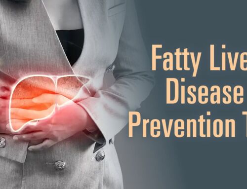Tips to Prevent Fatty Liver Disease