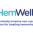 HemWell non-surgical hemorrhoid treatment procedure